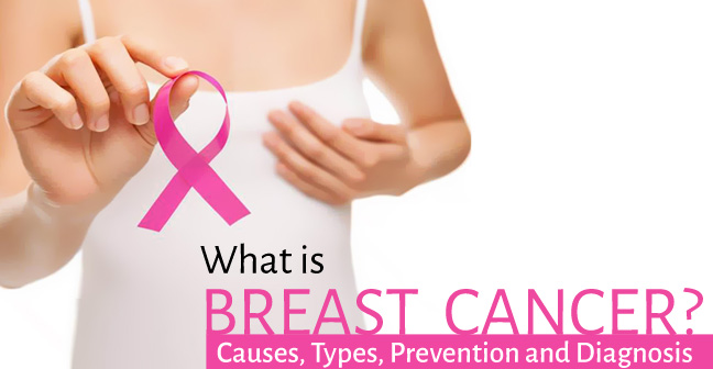 What is Breast Cancer- Causes, Types, Prevention and Diagnosis